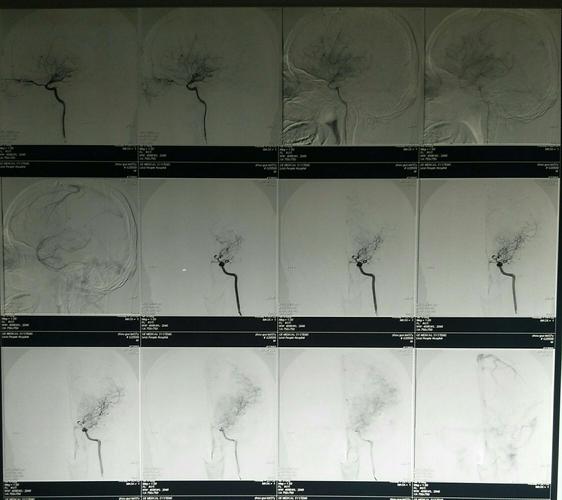 医院检查