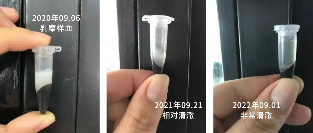 全面身体检查