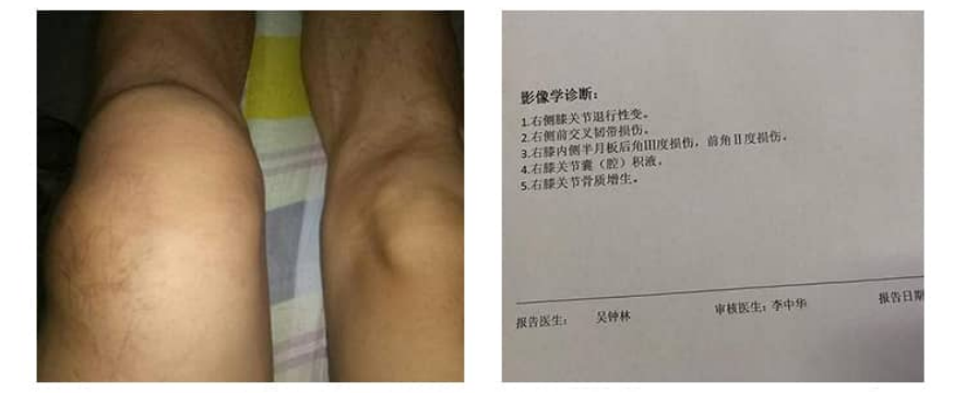 膝关节示意大图